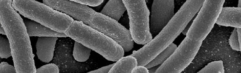 E. Coli